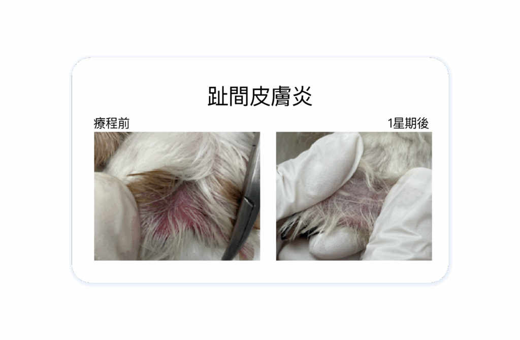 趾間皮膚炎