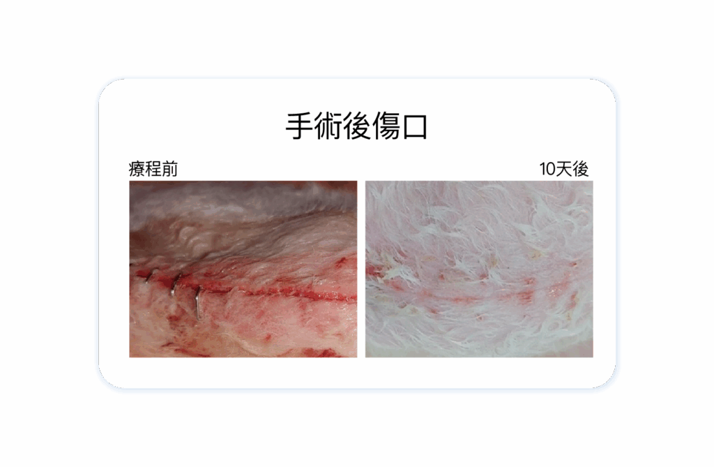 手術後傷口