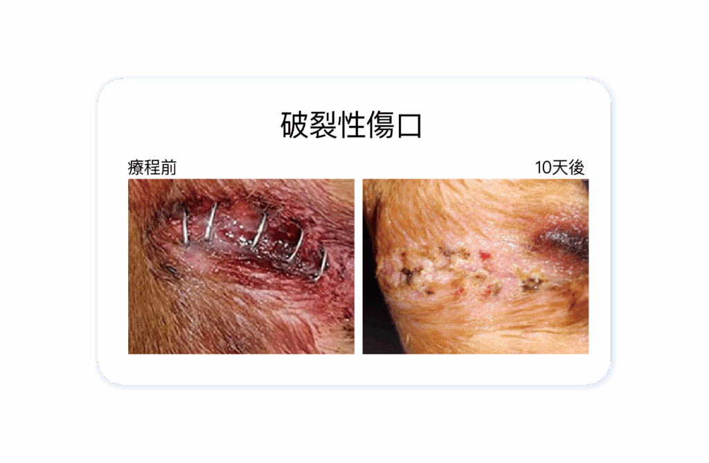 破裂性傷口